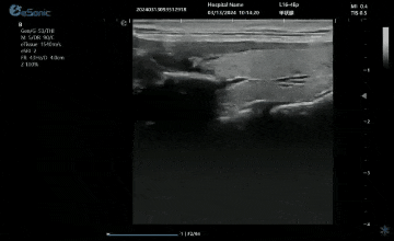 6.gif