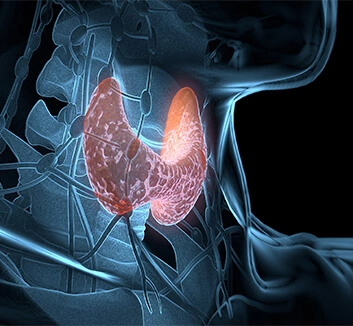 桥本氏甲状腺炎:甲状腺的"隐形刺客"来袭!(图3) pic01.png