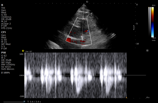 从近期“心源性猝死”高发看健康危机，您的冠脉还好吗？(图18)
