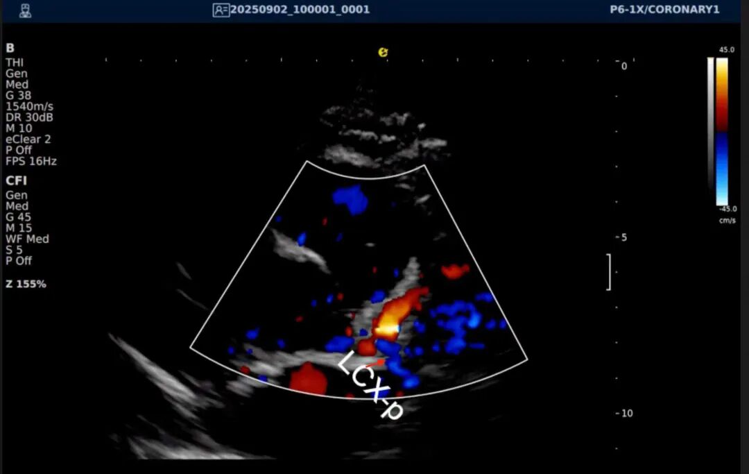 从近期“心源性猝死”高发看健康危机，您的冠脉还好吗？(图21)