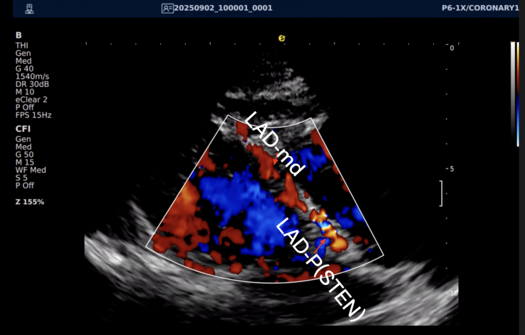 从近期“心源性猝死”高发看健康危机，您的冠脉还好吗？(图22)