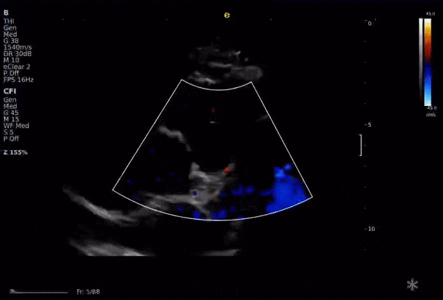 从近期“心源性猝死”高发看健康危机，您的冠脉还好吗？(图27)